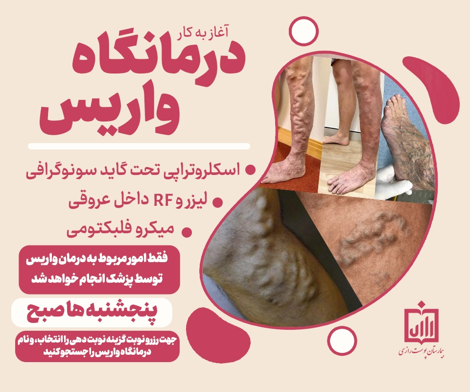  درمانگاه تخصصی واریس